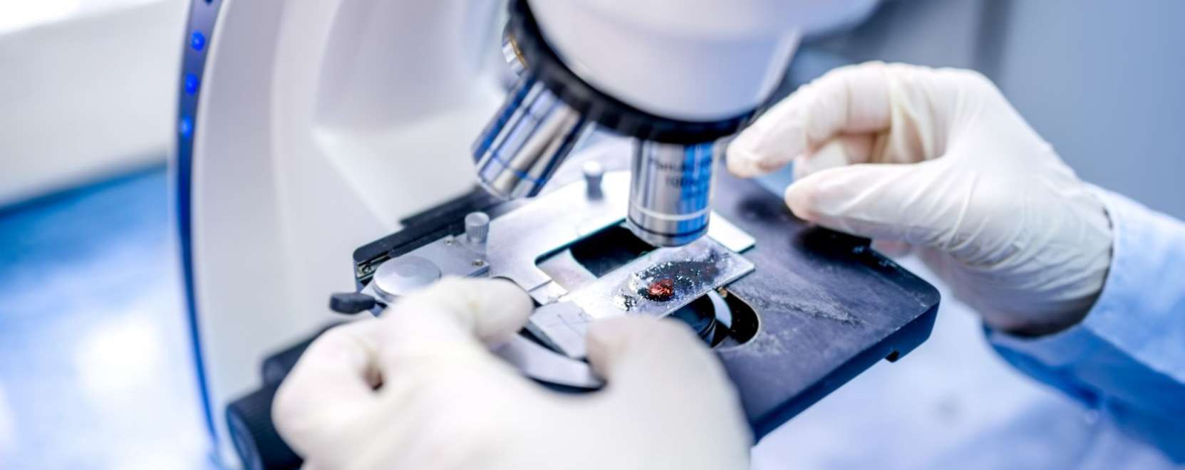 Okosmikroszk&oacute;ppal a j&aacute;rv&aacute;nyok ellen