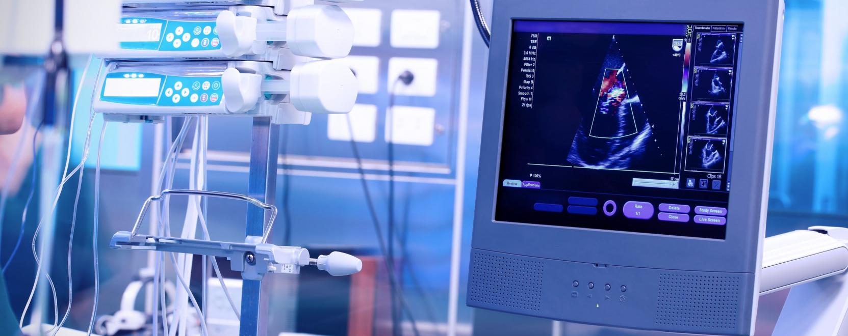 Ultrahang okosan: &uacute;j lehetős&eacute;gek a k&eacute;palkot&aacute;sban