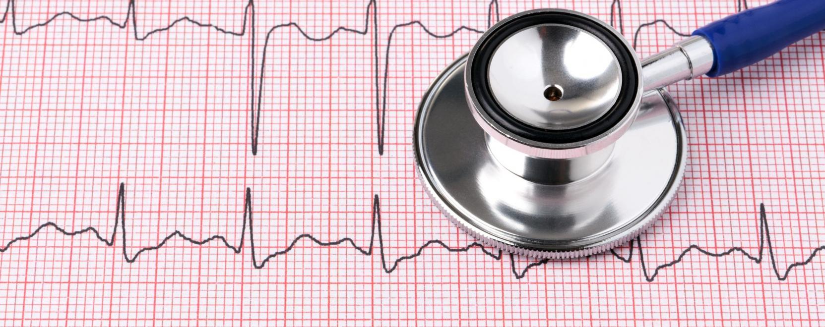 &Iacute;gy v&eacute;dheti sz&iacute;v&uuml;nket az okostelefon