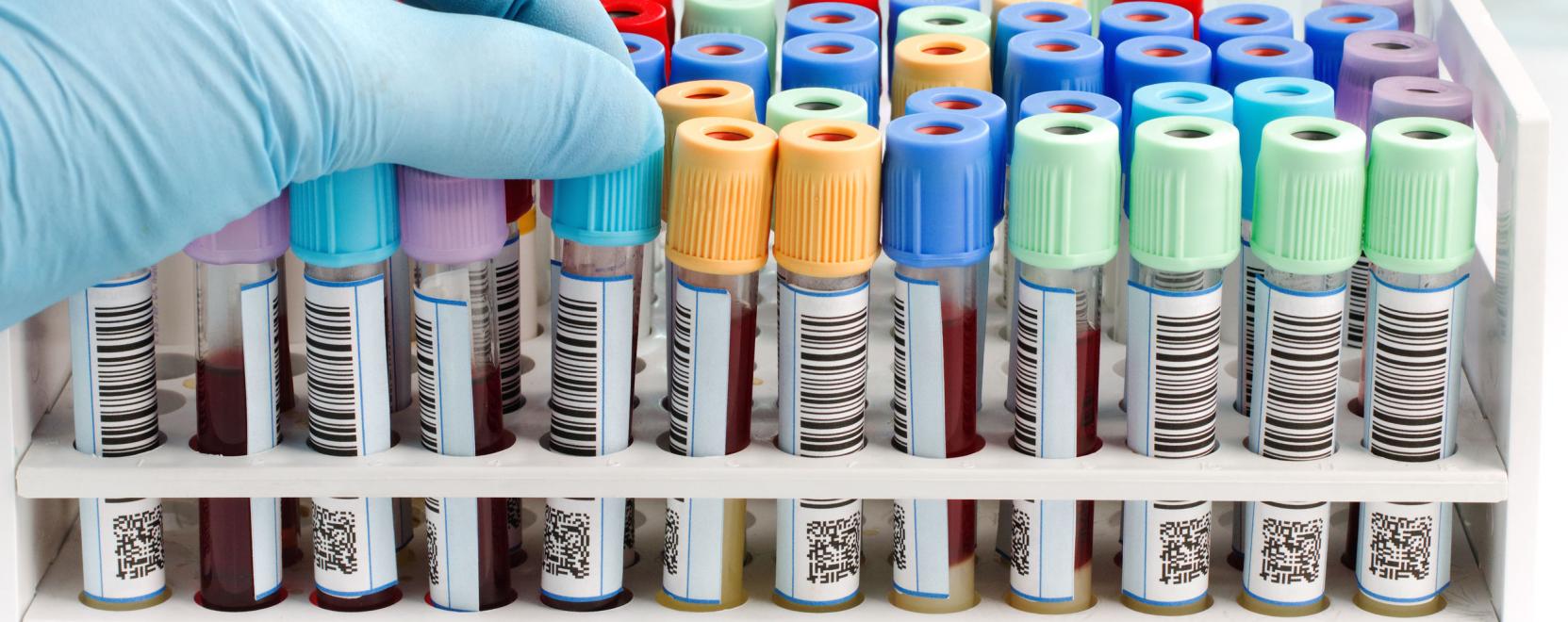 &Eacute;leteket menthet a magyar fejleszt&eacute;sű minilabor