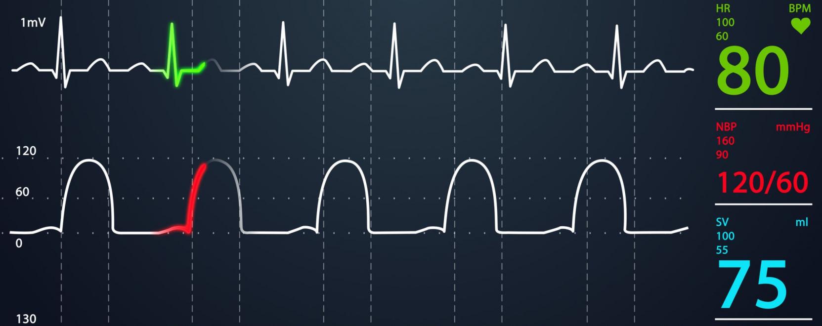 A sz&iacute;vritmus is biometrikus azonos&iacute;t&oacute;k&eacute;nt szolg&aacute;lhat