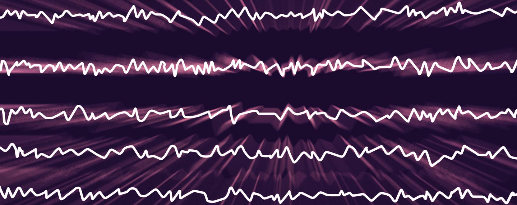 &Iacute;me, a vil&aacute;g legkisebb viselhető EEG-je