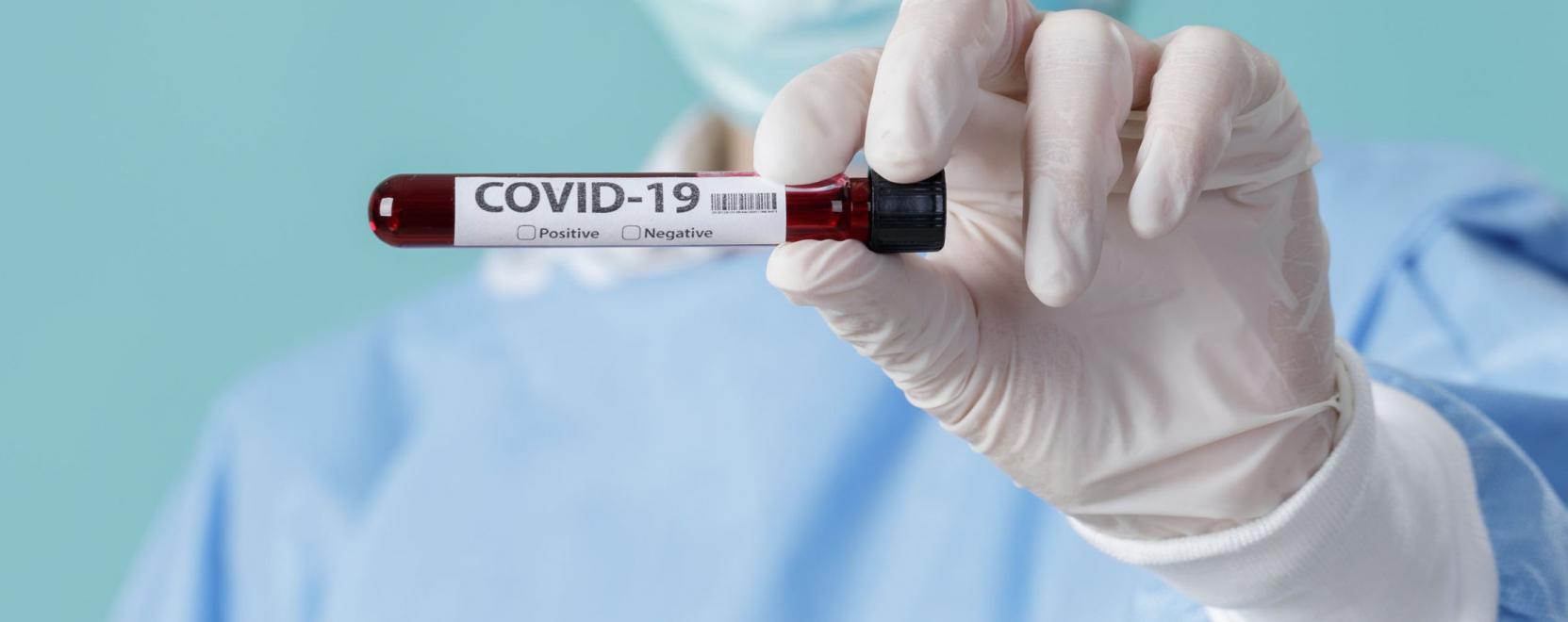 &Iacute;gy lehet biztons&aacute;gosabb a koronav&iacute;rus-teszt