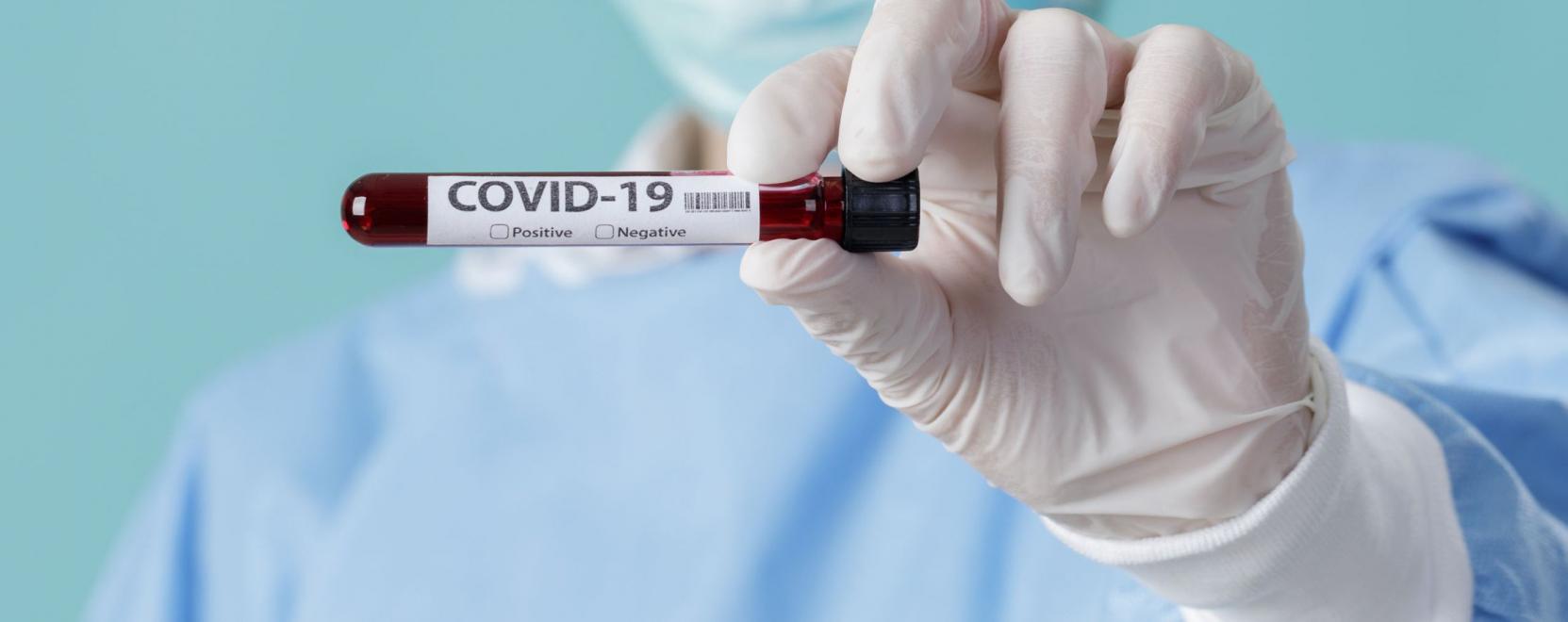 Innov&aacute;torok pr&oacute;b&aacute;lt&aacute;k meghackelni a koronav&iacute;rust