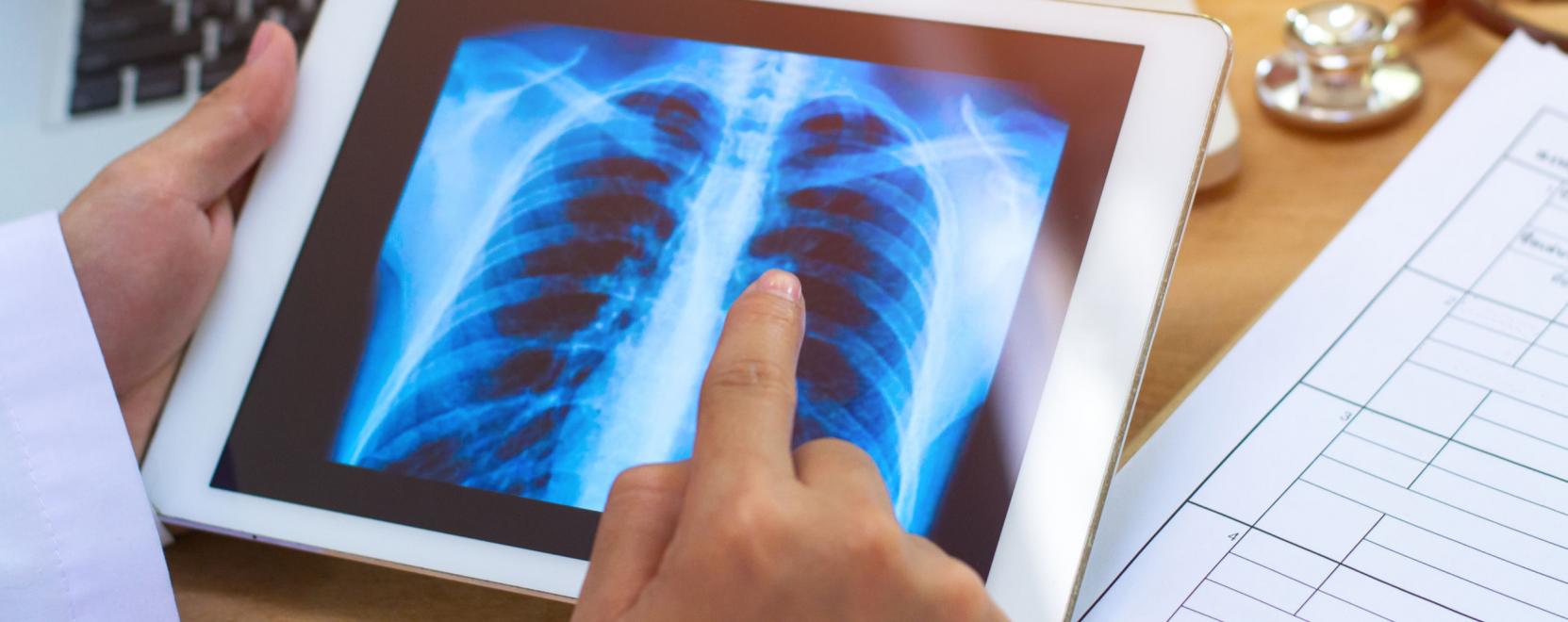 Headstart: előd&ouml;nt&ouml;s lett a magyar teleradiol&oacute;giai c&eacute;g