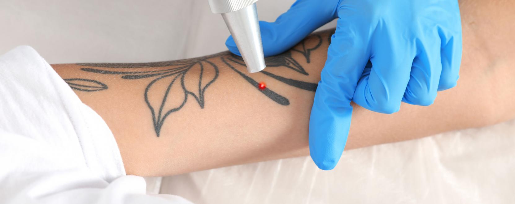 &Iacute;me, a j&ouml;vő tetov&aacute;l&aacute;sa: ilyen az igazi viselhető technol&oacute;gia