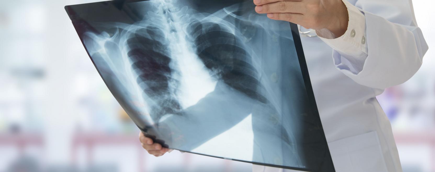 Haz&aacute;nkban elsők&eacute;nt tov&aacute;bb&iacute;tottak r&ouml;ntgenk&eacute;pet 5G h&aacute;l&oacute;zaton