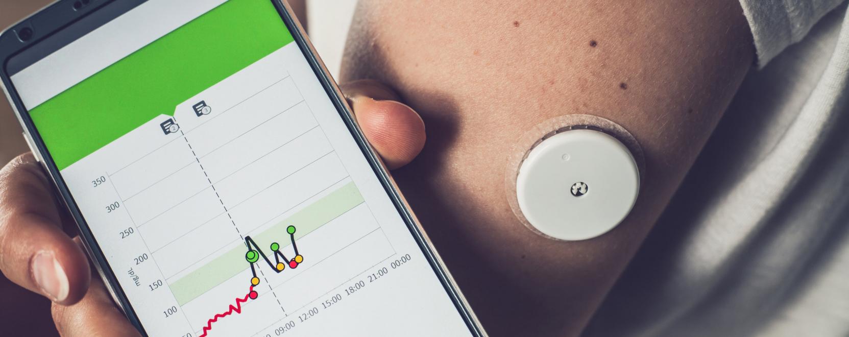 &Uacute;jabb viselhető eszk&ouml;z a tudatosabb &eacute;letm&oacute;d&eacute;rt