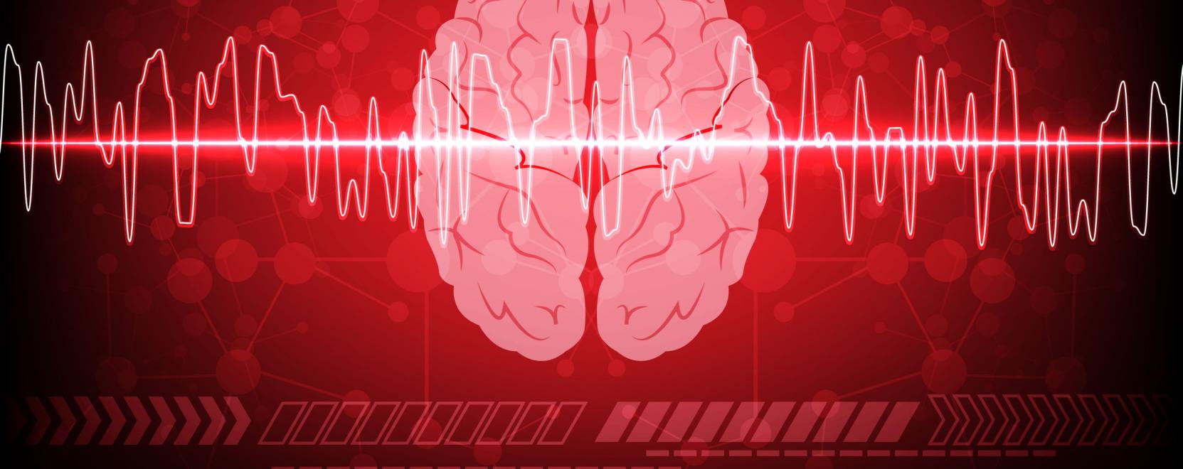2 milli&oacute; doll&aacute;r gyűlt &ouml;ssze a stroke figyelő eszk&ouml;zre