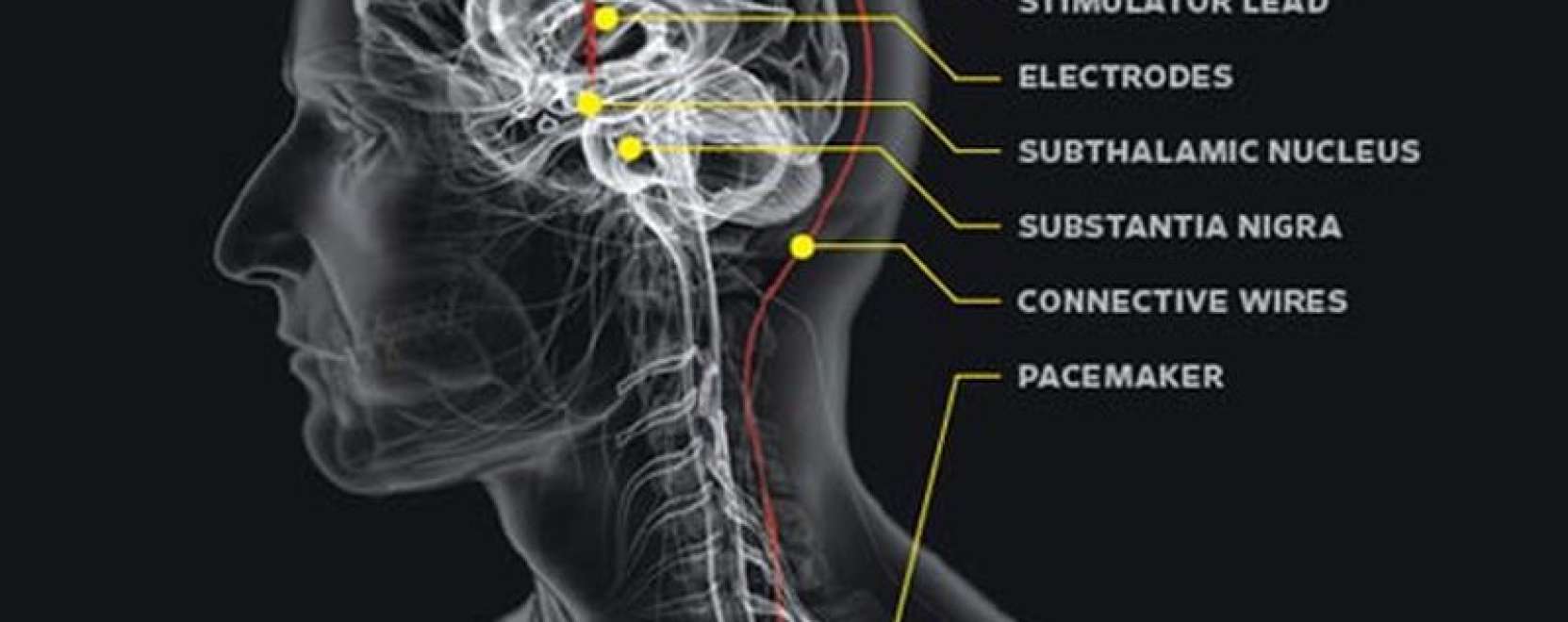 Mi m&aacute;r kiborgok vagyunk?