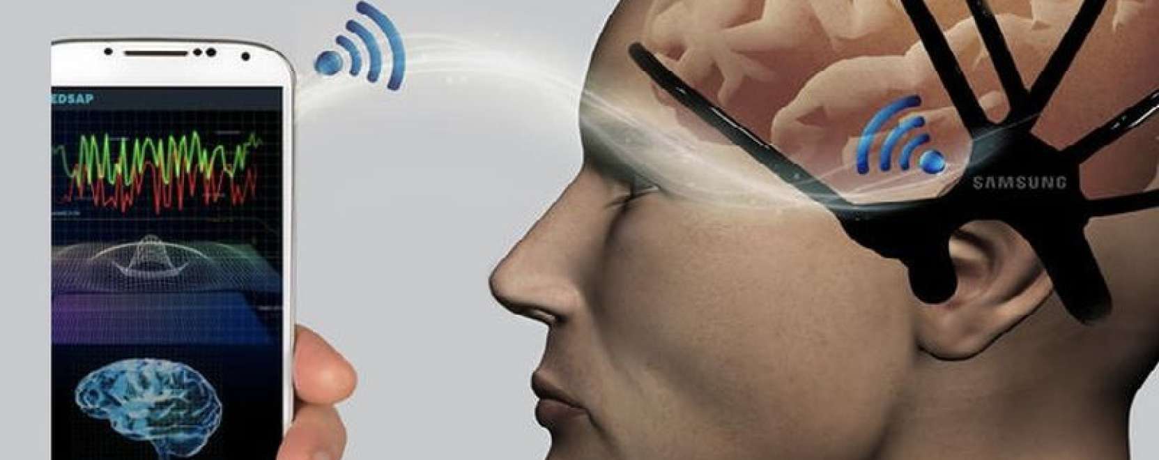 A k&ouml;zelgő agyv&eacute;rz&eacute;st is kiszűrheti az &uacute;j fejp&aacute;nt