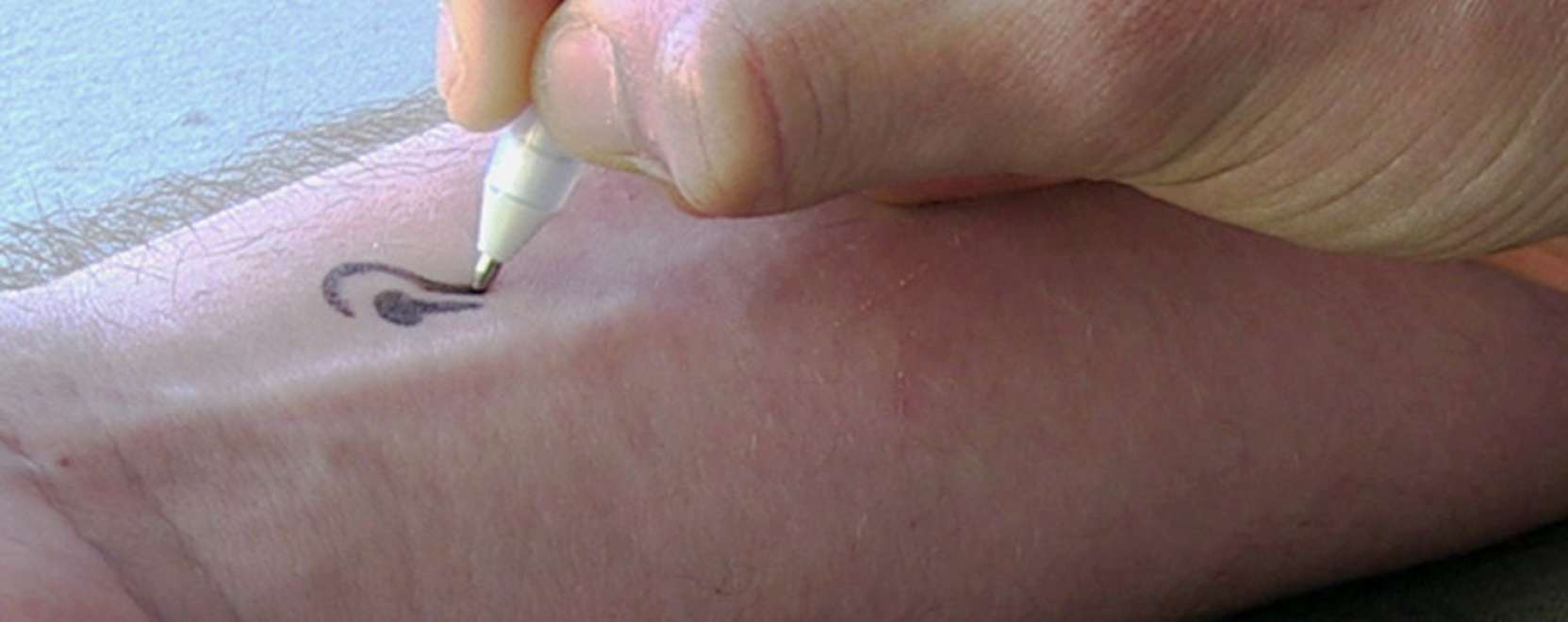 Rajzoljon bioszenzorokat a bőr&eacute;re